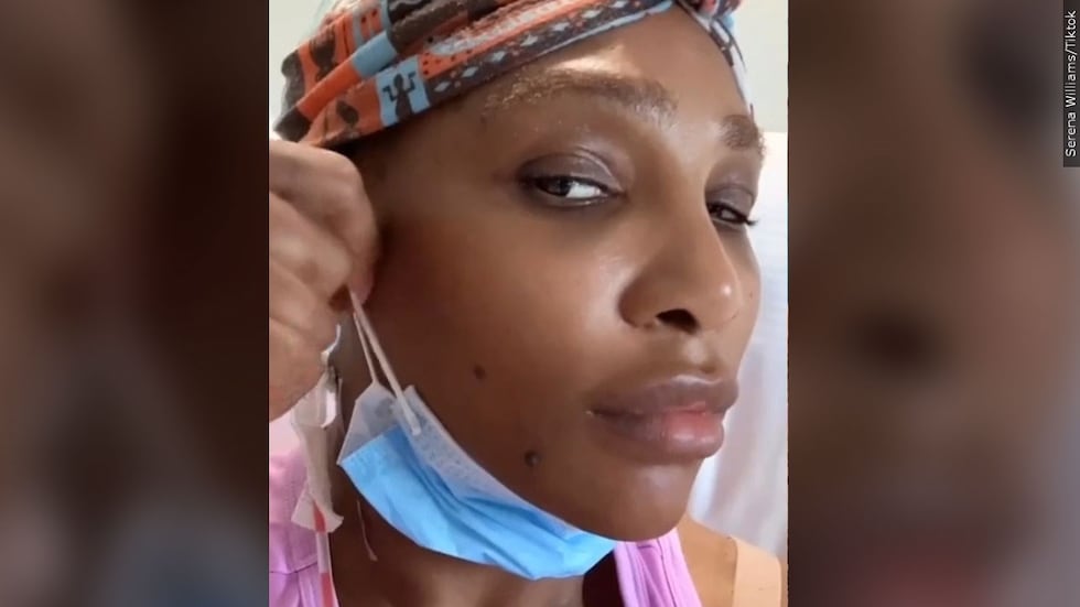 Tennis player Serena Williams revealed she had surgery to remove a cyst from her neck.